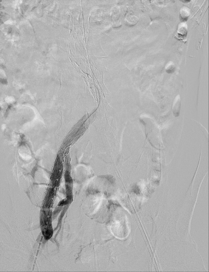 云南省文山州人民医院
