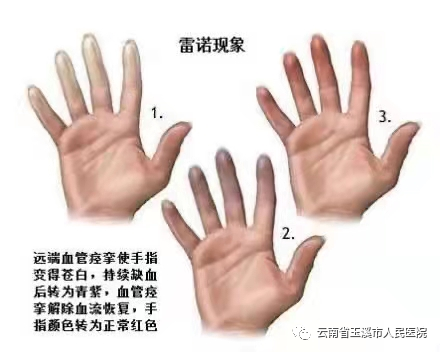 云南省玉溪市人民医院