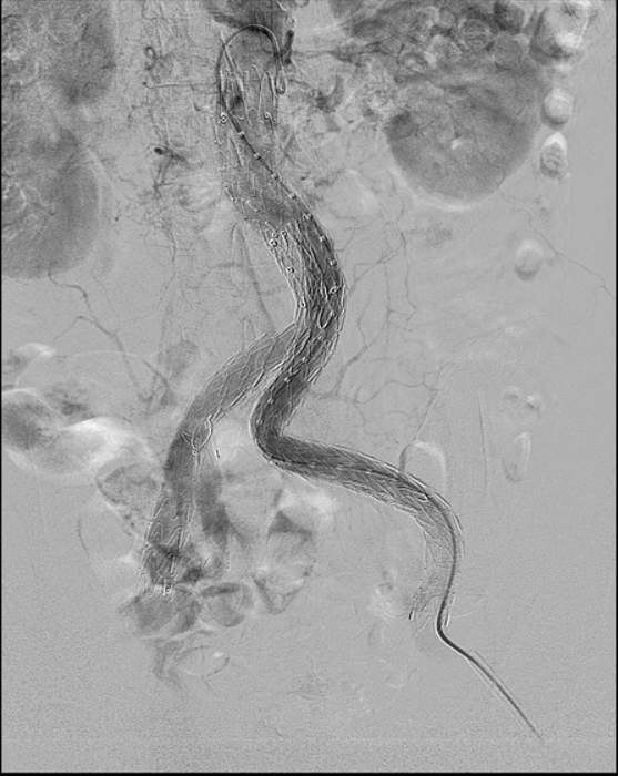 云南省文山州人民医院