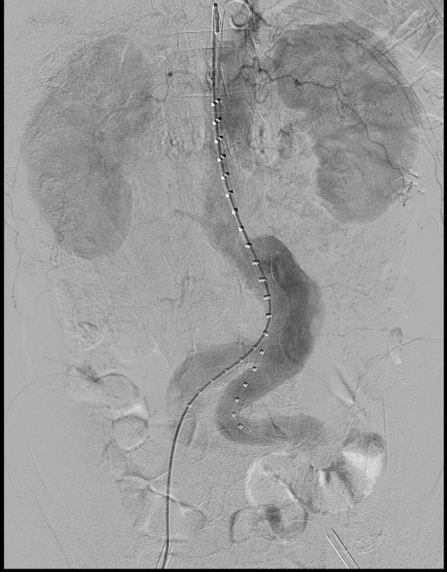 云南省文山州人民医院