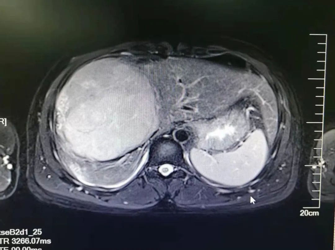 普洱市人民医院