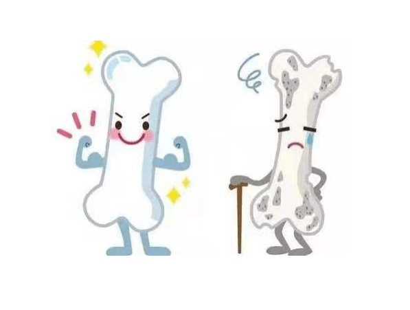 关注中老年人的骨密度健康