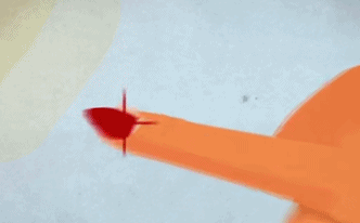 撕掉倒刺可能引起感染，正确处理靠剪刀+护手霜 