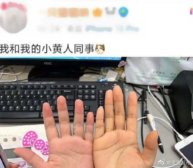 砂糖橘吃多了皮肤会变黄 