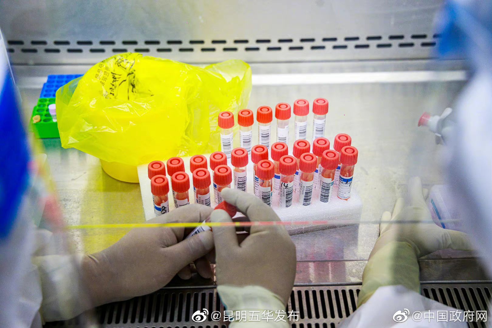 《新冠病毒核酸20合1混采检测技术规范》发布