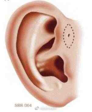 为什么有的人耳朵上长了一个洞?