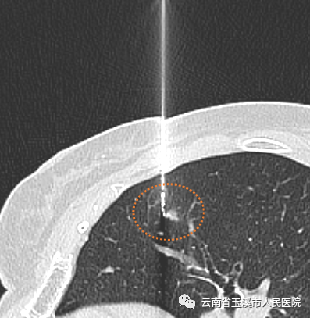 云南省玉溪市人民医院