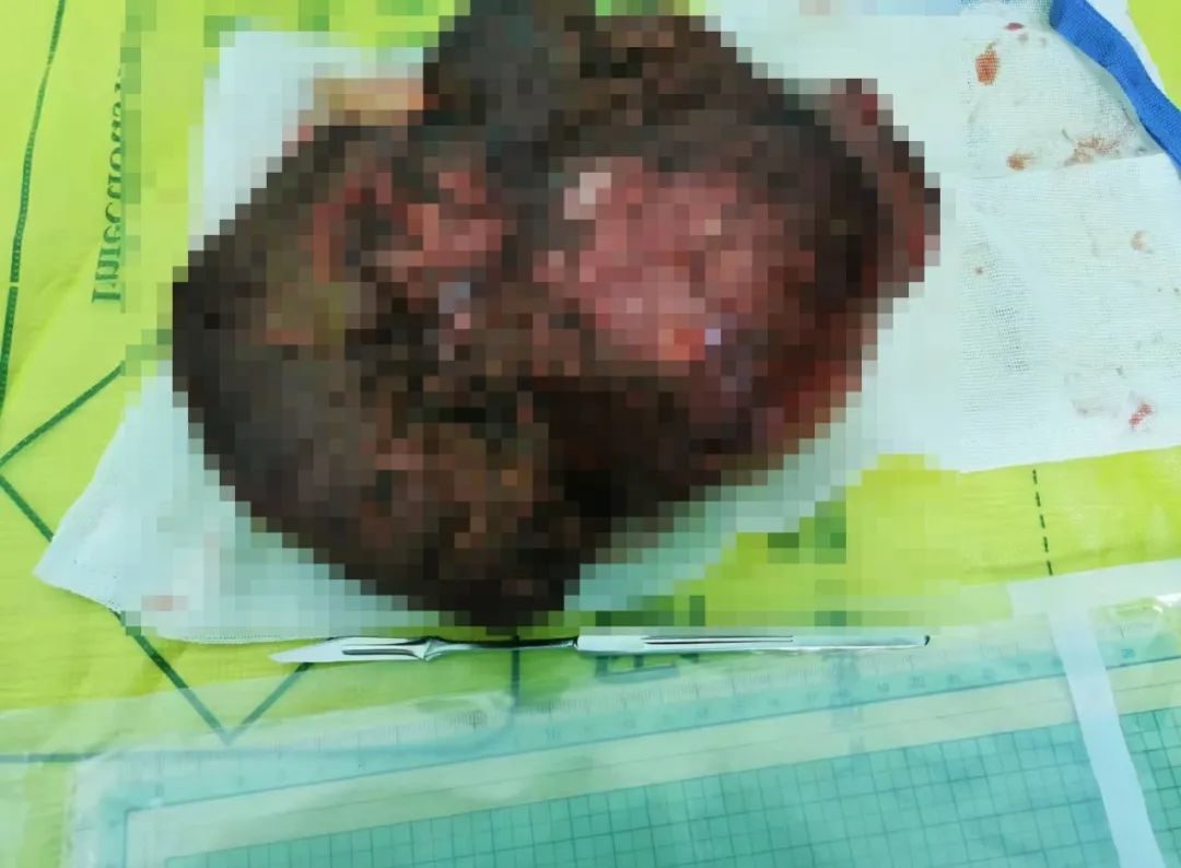 普洱市人民医院