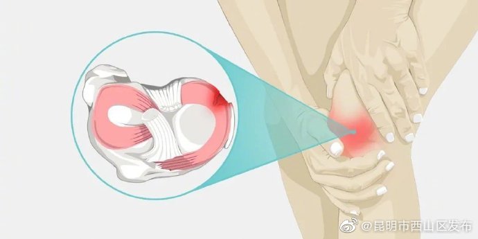 “昆明市西山区发布”微博