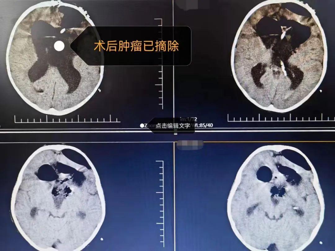 思茅区人民医院