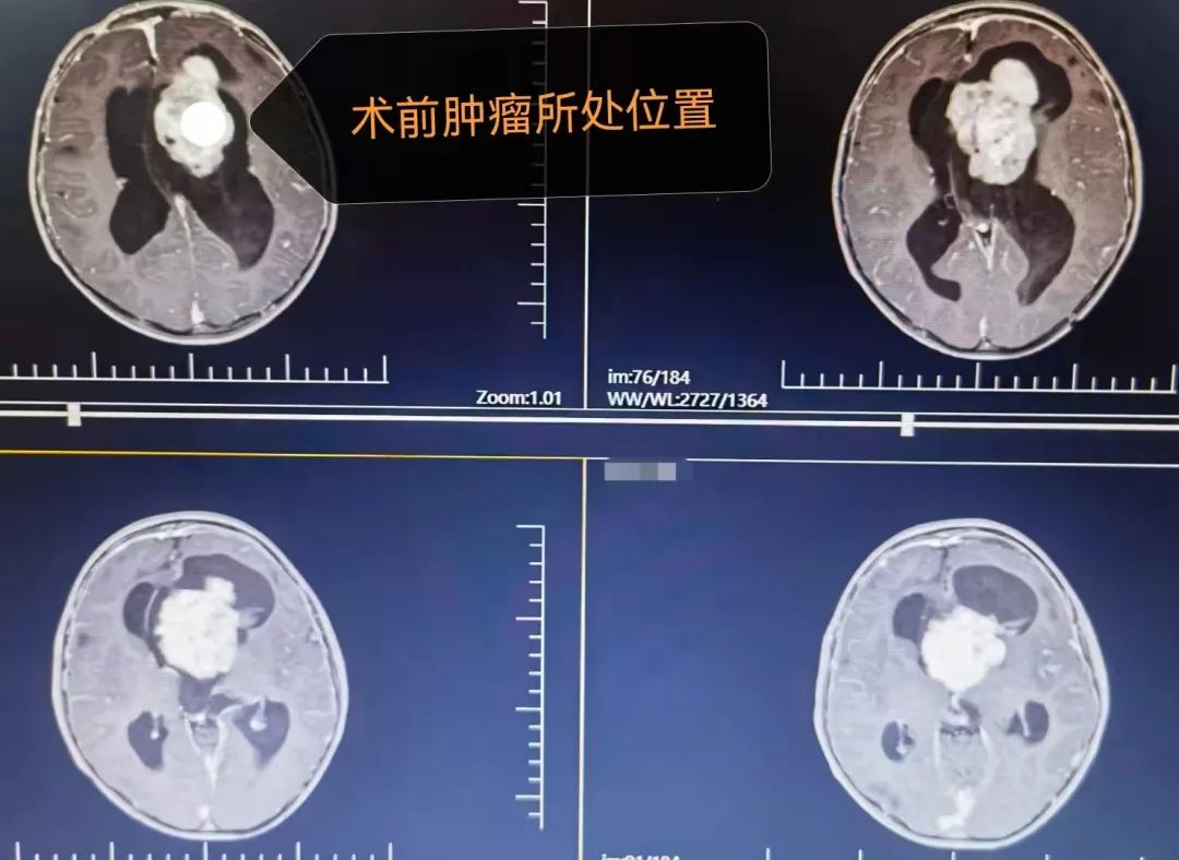 思茅区人民医院