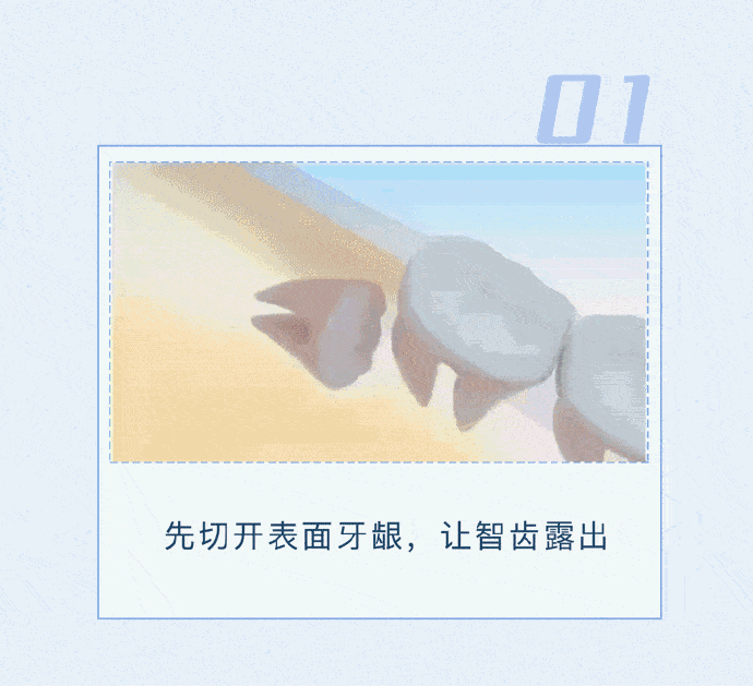 “昆明市西山区发布”微博