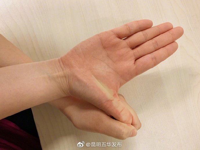 “昆明五华发布”微博