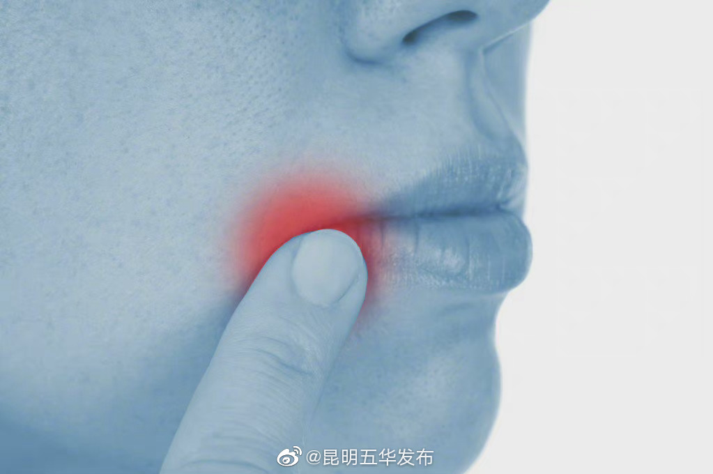 口腔溃疡超两周不好要警惕，自查有无6个症状