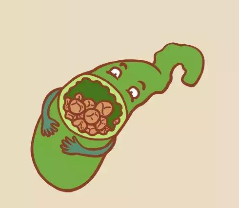 胆结石与饮食有关系吗？