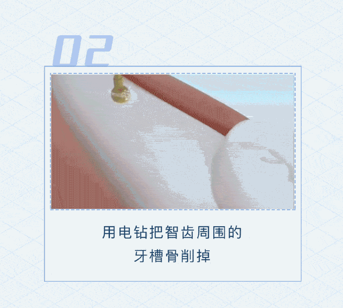 “昆明市西山区发布”微博