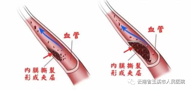 云南省玉溪市人民医院