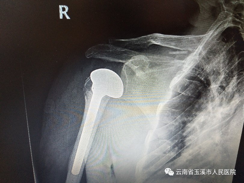 云南省玉溪市人民医院