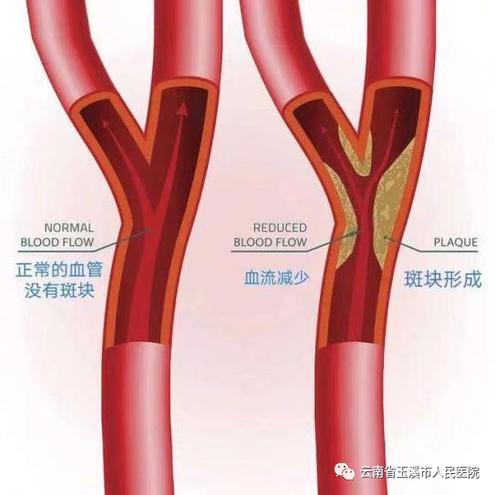 云南省玉溪市人民医院