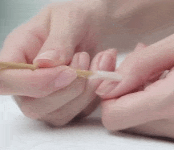 做美甲时，去除指甲根部死皮易引发感染