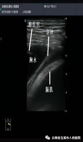 云南省玉溪市人民医院