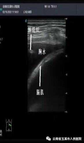 云南省玉溪市人民医院