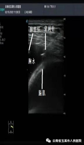 云南省玉溪市人民医院