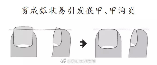 “昆明五华发布”微博