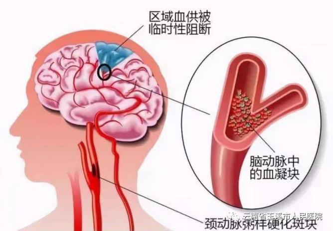 云南省玉溪市人民医院