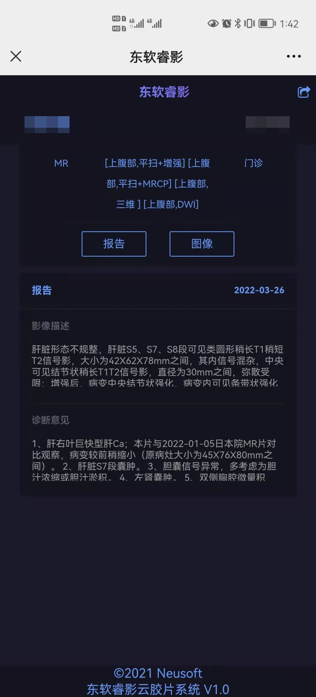 普洱市人民医院