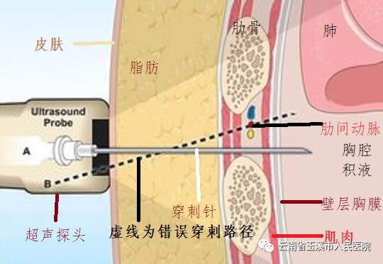 云南省玉溪市人民医院