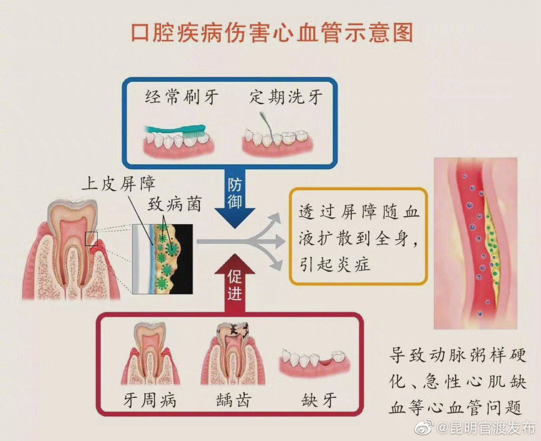 一图看清：牙不好是怎样连累心血管的