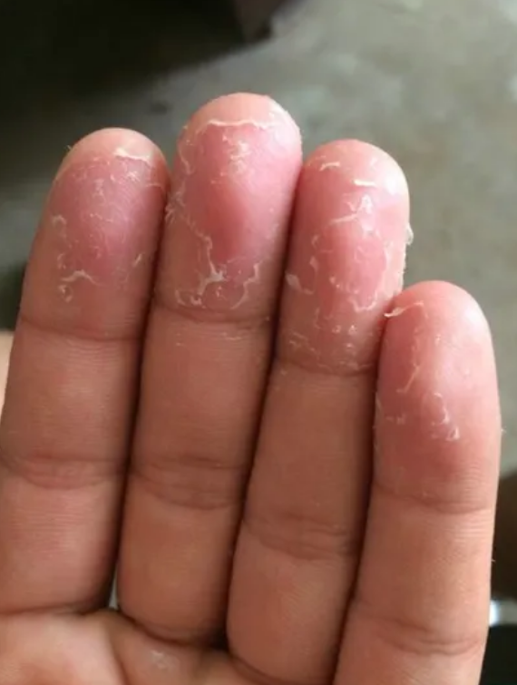 美丽云南微科普