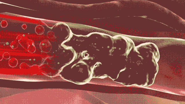 胸闷犯困可能是血液粘稠了 