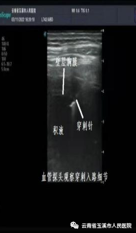 云南省玉溪市人民医院