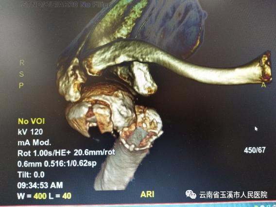 云南省玉溪市人民医院