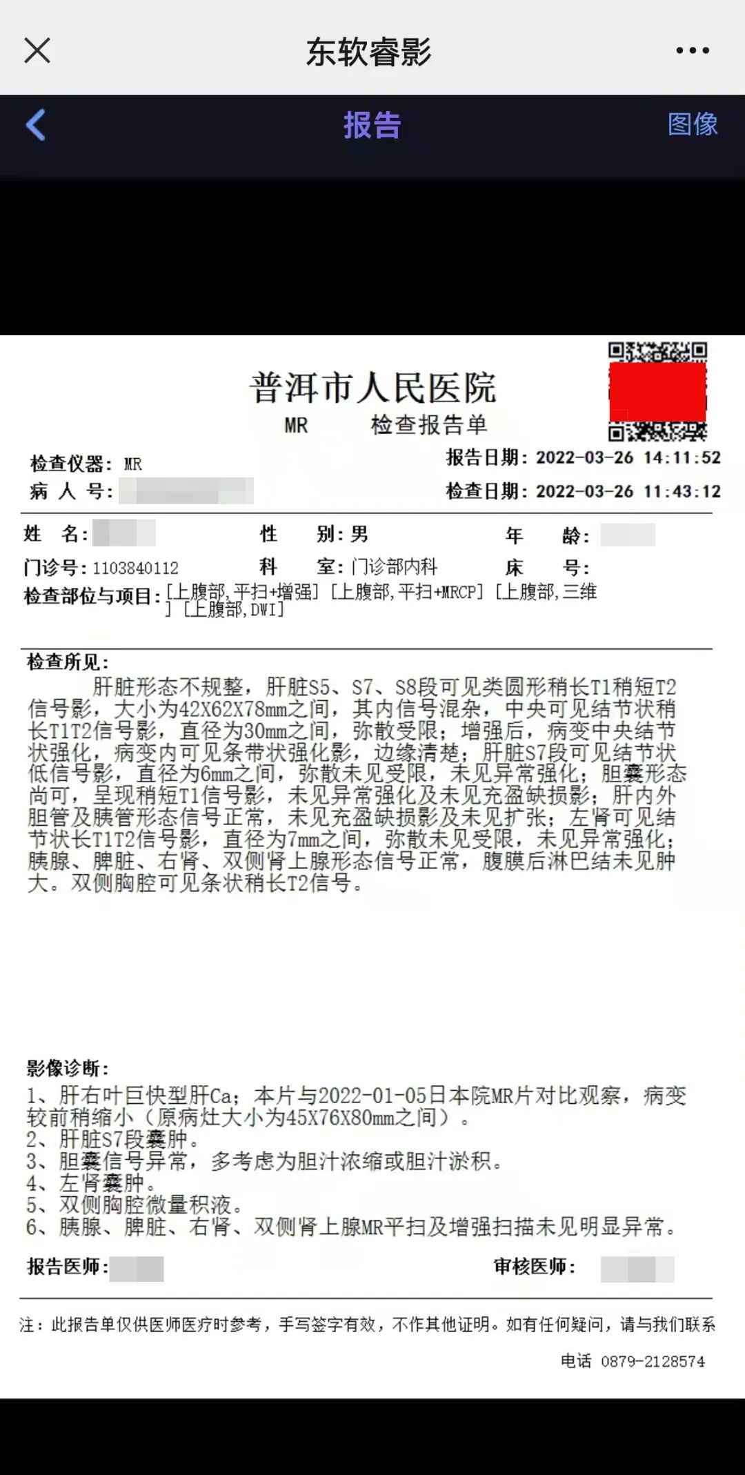 普洱市人民医院