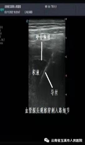 云南省玉溪市人民医院