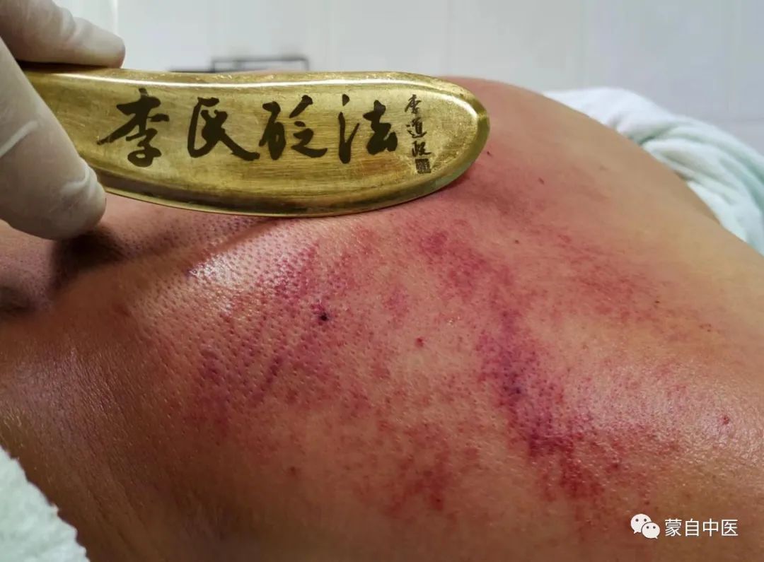 蒙自中医