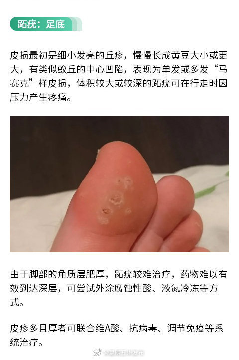 “昆明五华发布”微博
