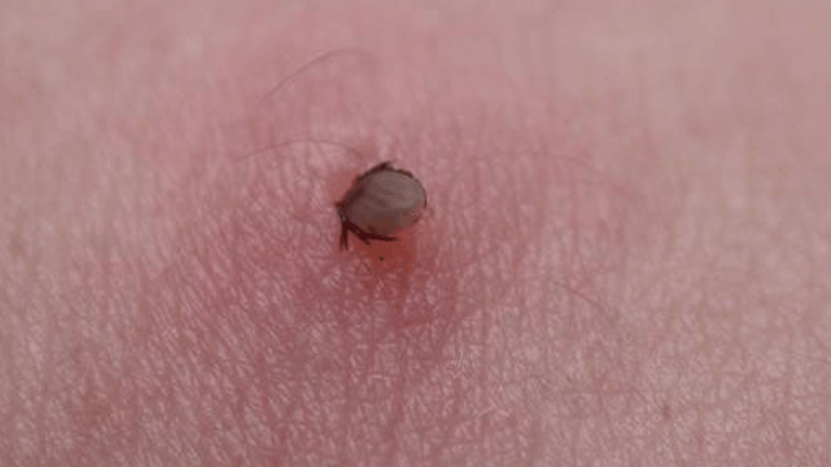 健康腾冲