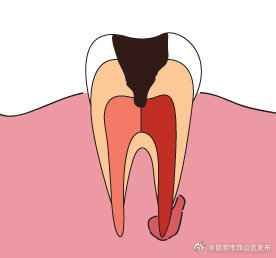 昆明市西山区发布