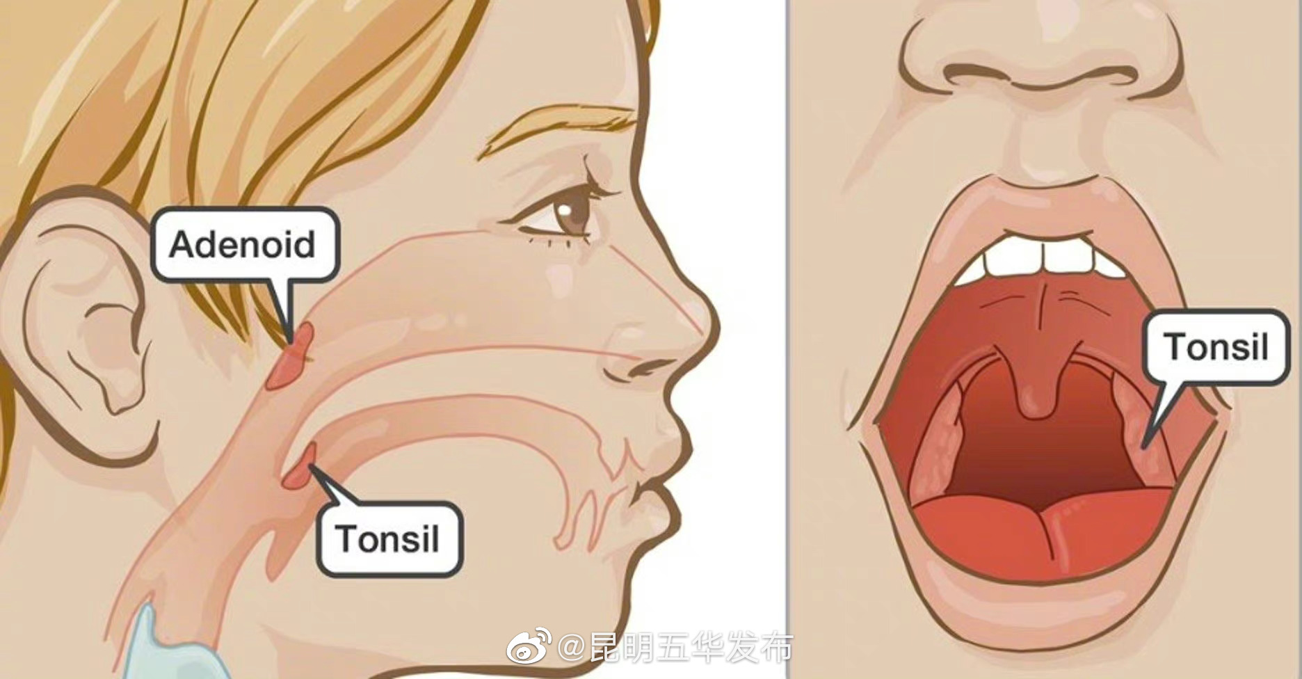 “昆明五华发布”微博