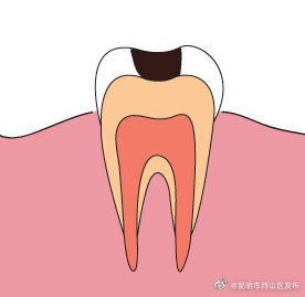 昆明市西山区发布