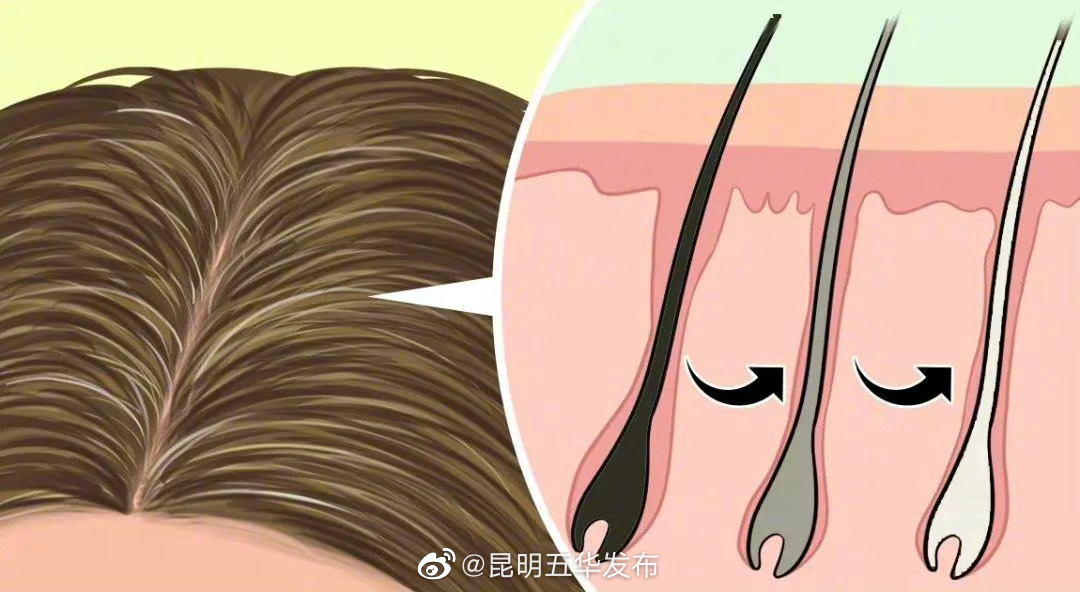 熬夜久坐会加速白发生成，让白头发来得晚一点