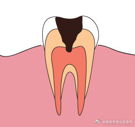 昆明市西山区发布