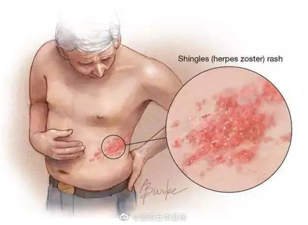 “昆明五华发布”微博