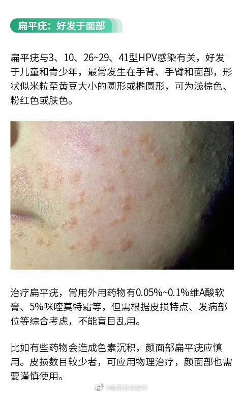 “昆明五华发布”微博