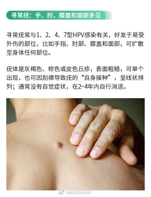 “昆明五华发布”微博