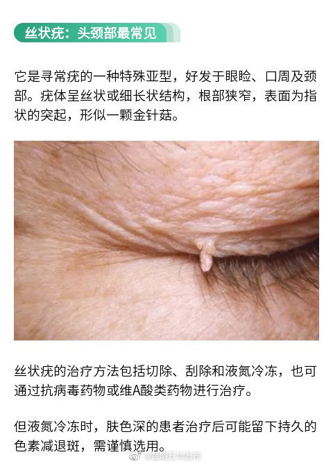 “昆明五华发布”微博
